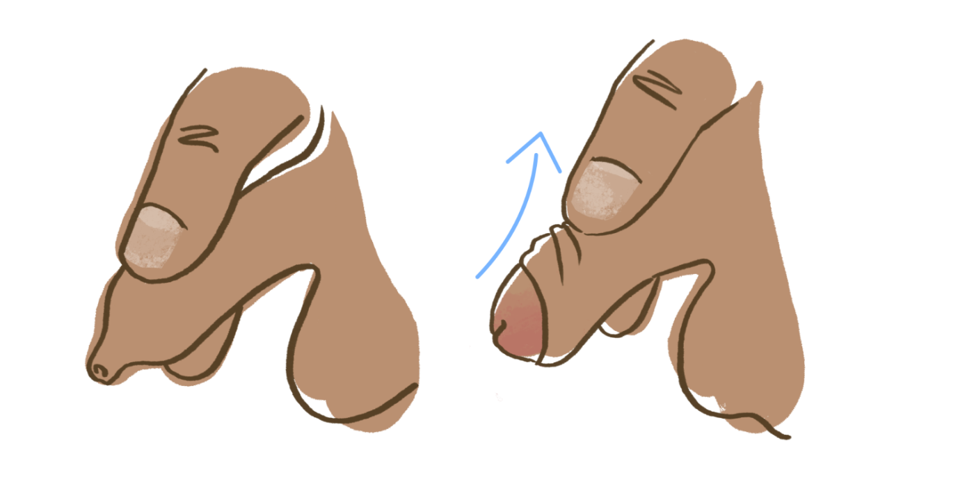 Foreskin