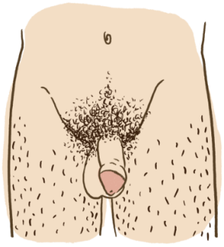 Circoncis